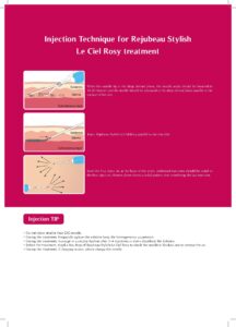 Rejubeau Stylish Le Ciel Rosy PLLA 365mg Derma Filler